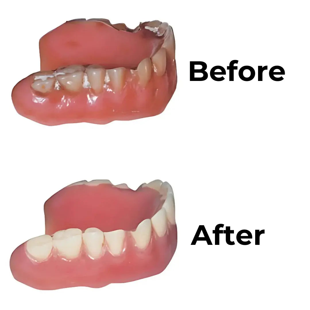 Ultrasonic UV-C Denture Dome