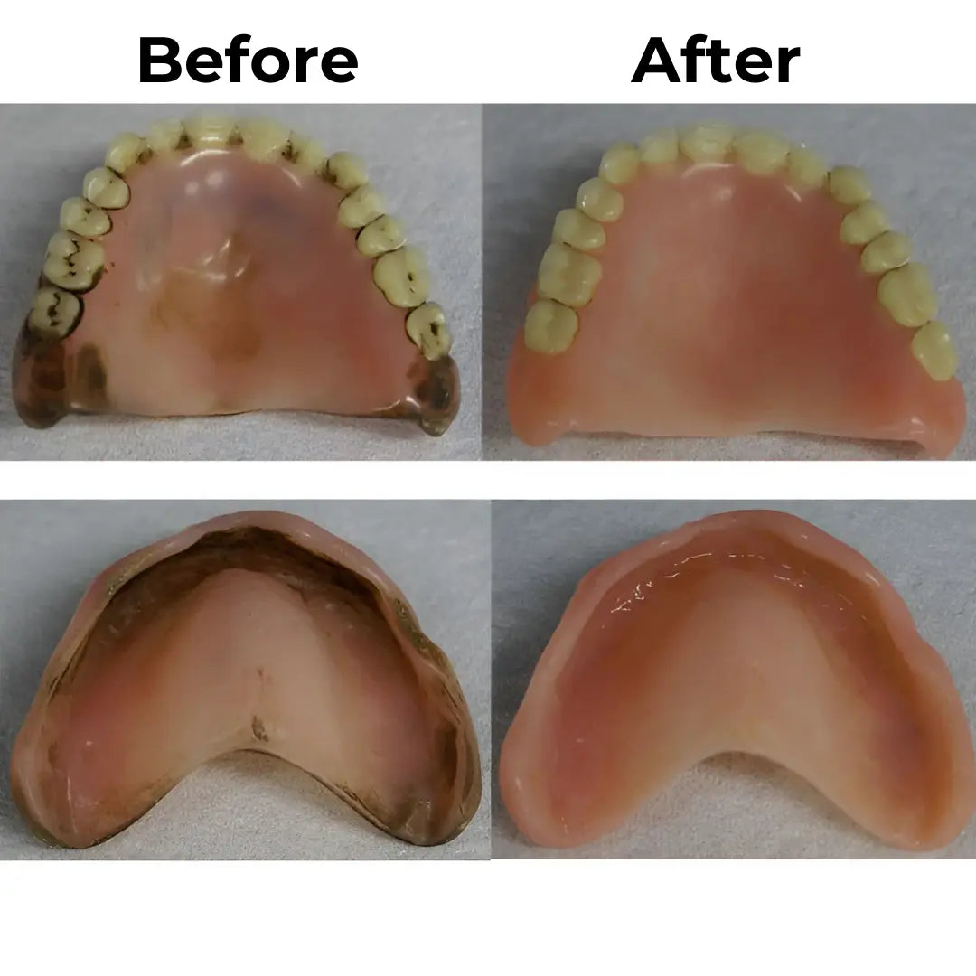 Ultrasonic UV-C Denture Dome